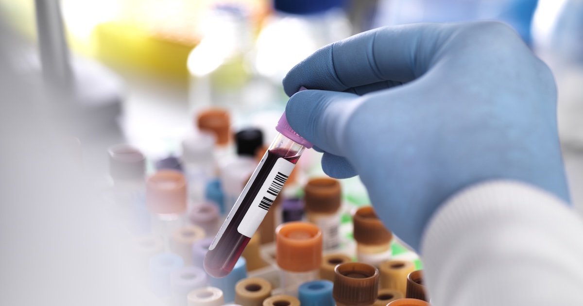 Blood samples in vacutainers. 