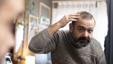 Man examining his hair and scalp