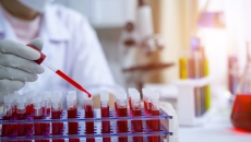 Scientist with test tubes filled with blood