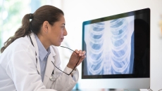 A doctor reviewing a patient's chest X-ray image