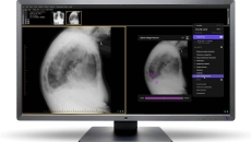 A desktop computer view of the Annalise CXR platform
