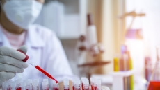 Clinician analyzing blood samples