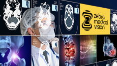 Zebra Medical Vision
