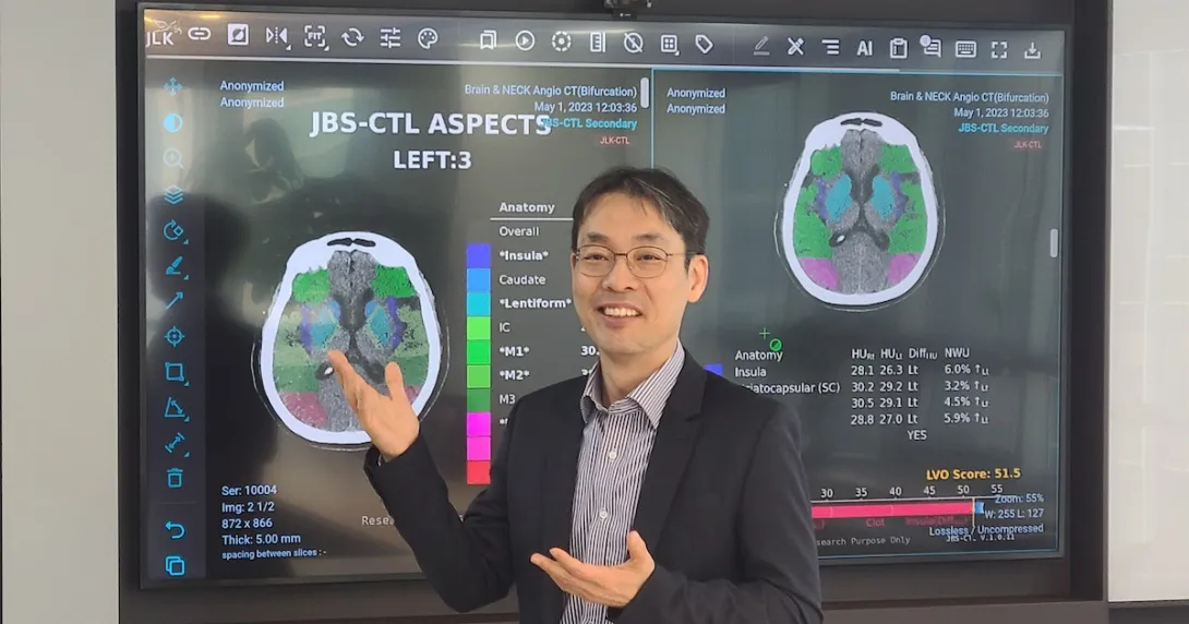 JLK CEO Dong-Min Kim showcasing their stroke AI solution