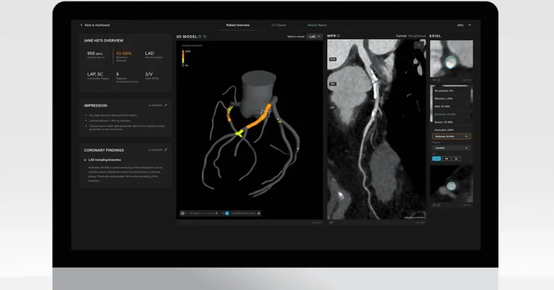 Artrya Salix AI-powered coronary plaque assessment software