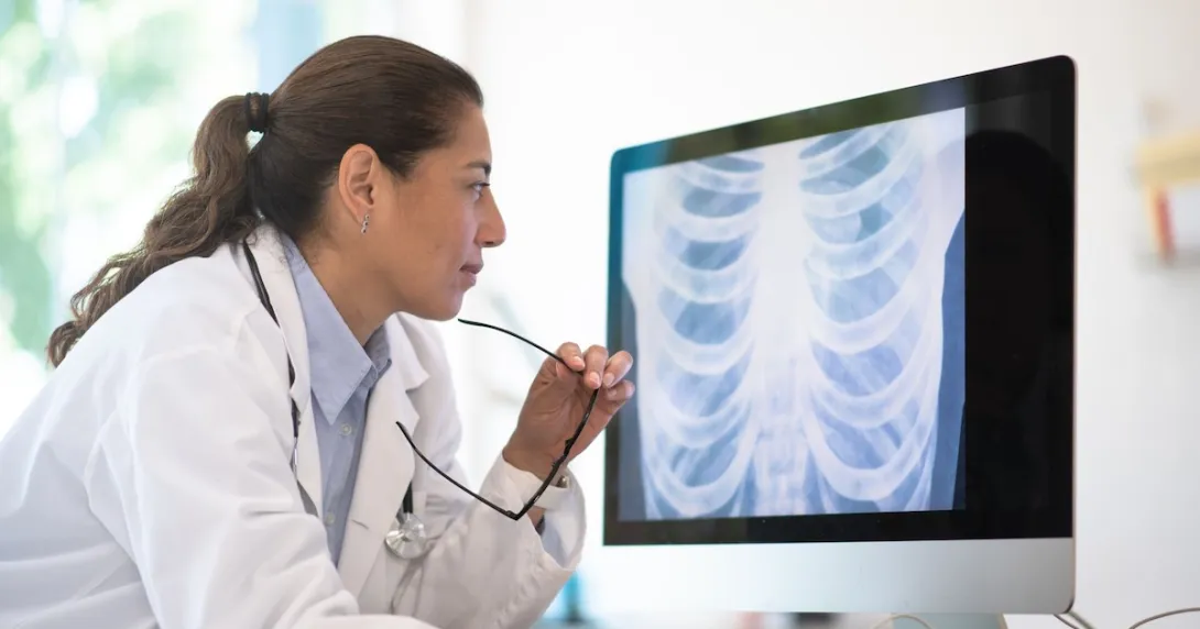 A doctor reviewing a patient's chest X-ray image