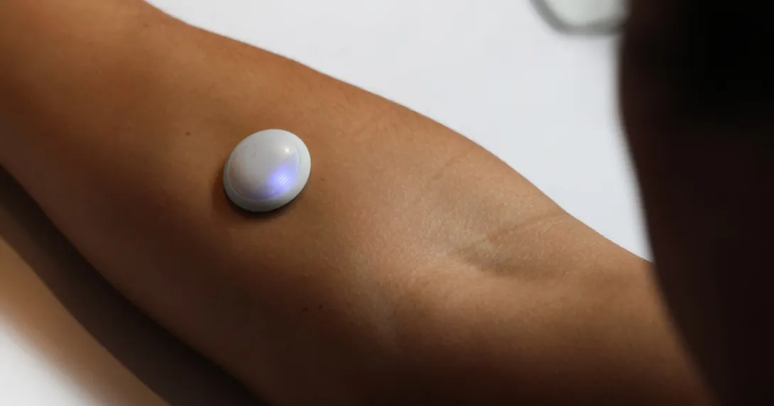 Biolinq glucose sensor