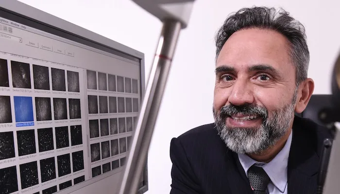 corneal confocal microscopy, COVID-19, long COVID, ophthalmology, Weill Cornell Medicine-Qatar