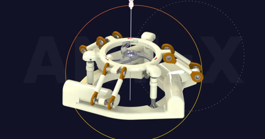 Photo of NDR's ANT-X system