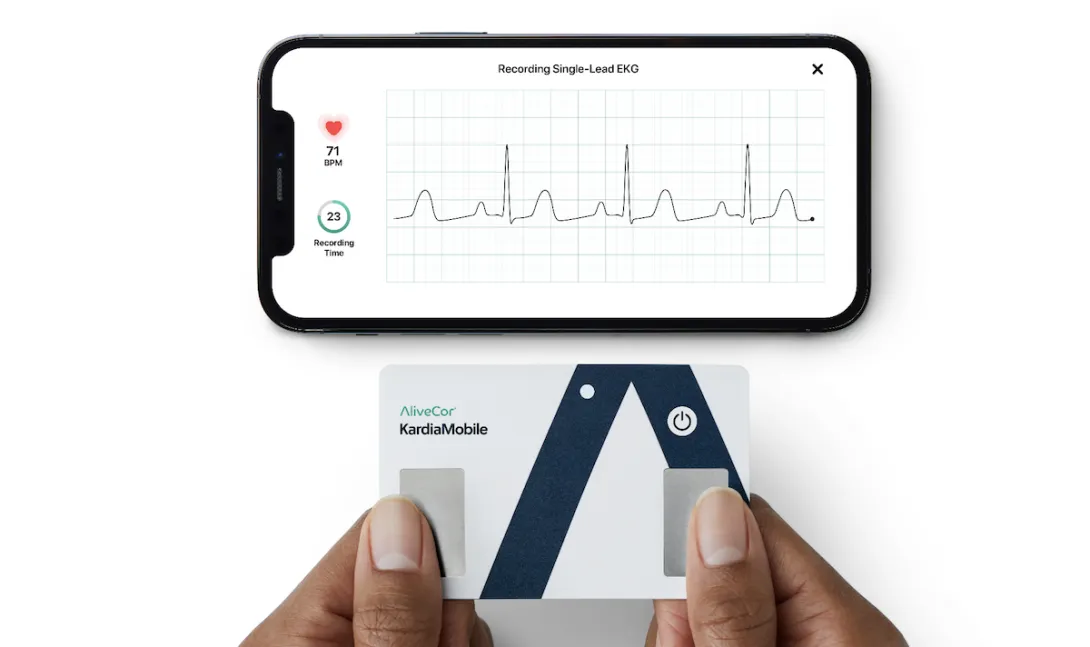 AliveCor screen
