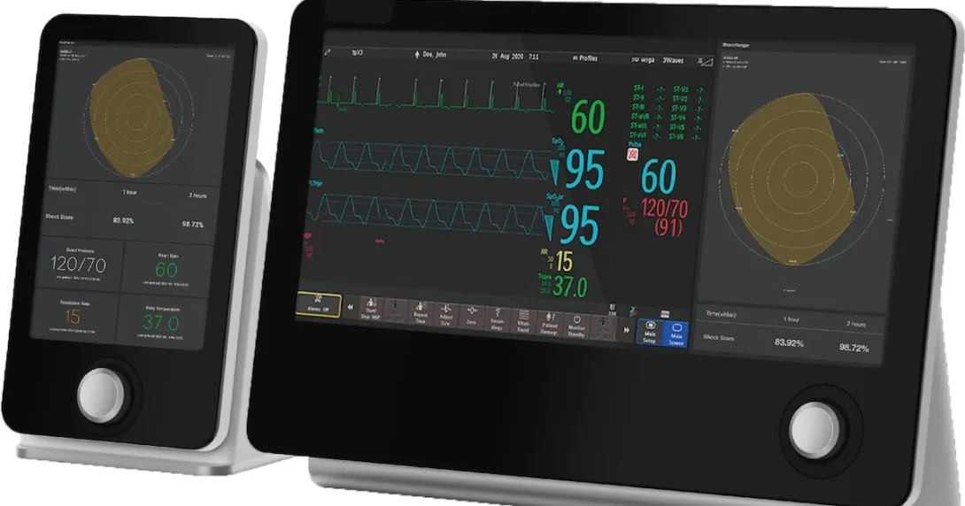 SpassMed's AI-powered software for sepsis detection on mobile phone and digital tablet